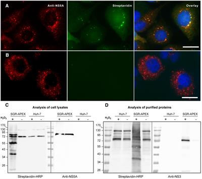 Hepatitis C virus alters the morphology and function of peroxisomes